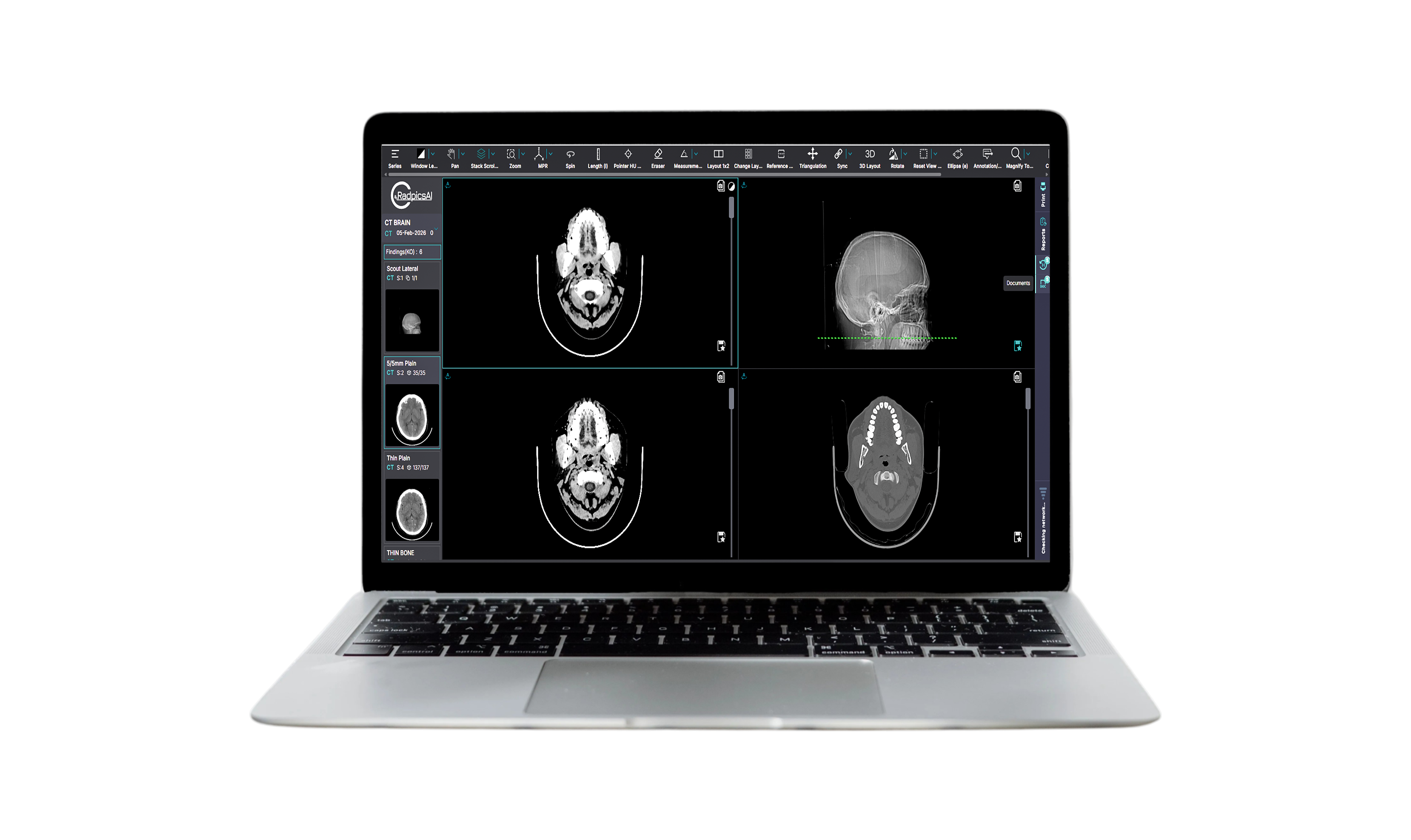 MEDVIEWER enterprise DICOM viewer