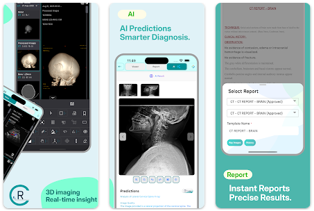 RadpicsAI Mobile App